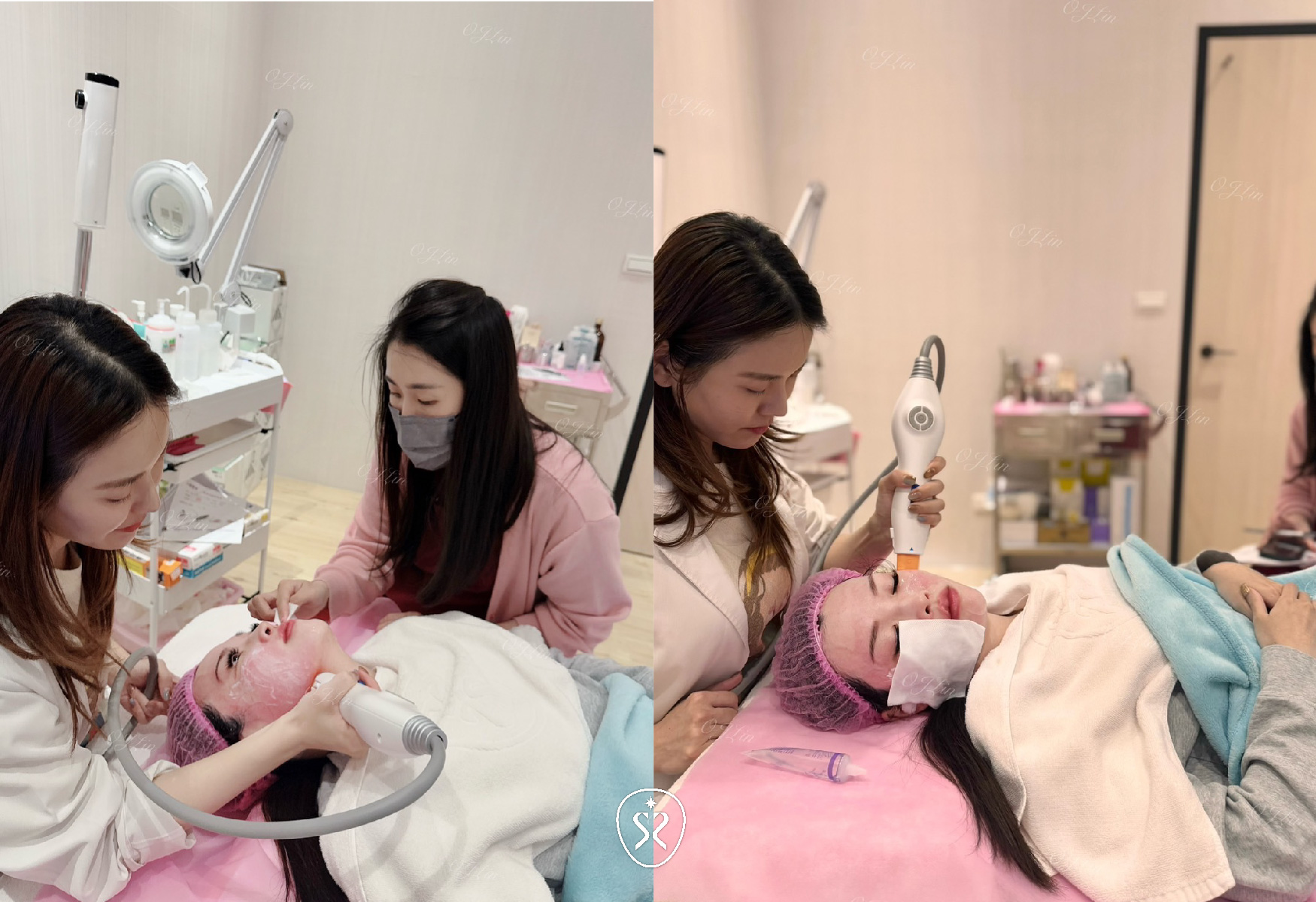 玩美電波為非侵入式電波治療系統，採容積式加熱，將能量從表皮層深入到皮下組織，促進膠原蛋白增生，以達到緊緻肌膚的效果